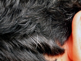 6 remédios caseiros para combater a aparição precoce dos cabelos brancos