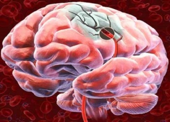 Descubra 5 formas de favorecer o fluxo sanguíneo cerebral