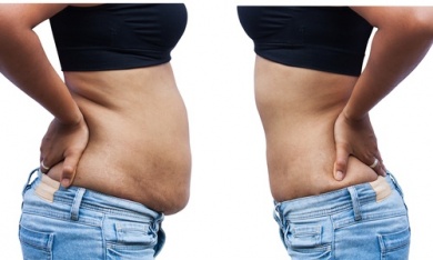 8 razões pelas quais o abdômen tende a acumular gordura
