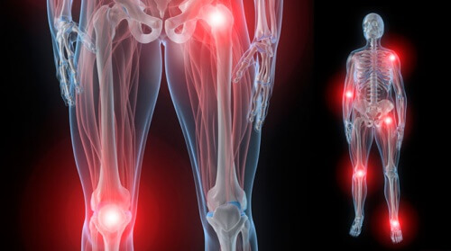 Conheça a dor articular noturna e confira dicas para aliviá-la Conheça a dor articular noturna e confira dicas para aliviá-la