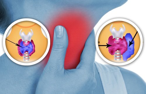 8 produtos para o lar que afetam a nossa tireoide