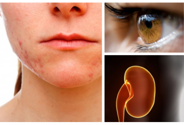 Quais são os órgãos afetados quando sofremos com o estresse?