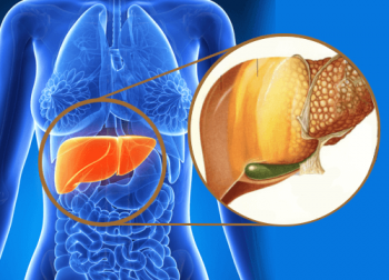 O que é o fígado gorduroso? Como tratá-lo?