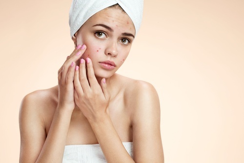 Azeite de oliva para combater a acne