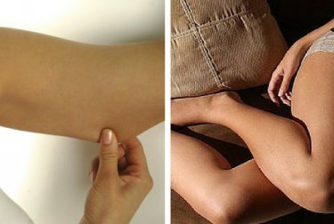 Como conseguir firmeza nos braços e pernas