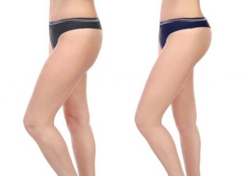 Exercícios para ter coxas mais magras e tonificadas