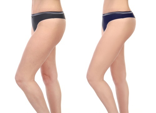Exercícios para ter coxas mais magras e tonificadas