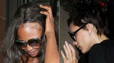 5 conselhos para esconder a escassez de cabelo