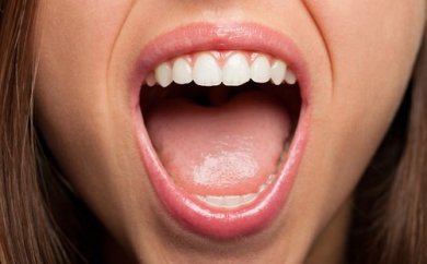 6 problemas bucais que indicam a presença de doenças