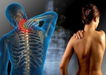 Dor muscular e fadiga crônica? Pode ser fibromialgia