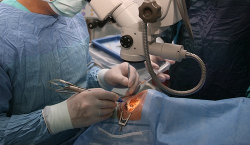Cirurgia-na-visão