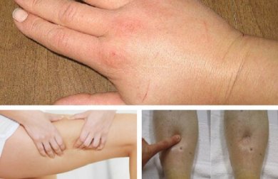 8 diuréticos naturais que ajudam a combater a retenção de líquidos