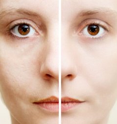 5 ingredientes naturais que ajudam a eliminar as manchas escuras