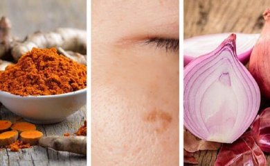Você tem manchas na pele? Estes 6 remédios caseiros ajudarão a reduzi-las