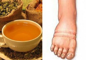 As 4 melhores plantas para combater a retenção de líquidos