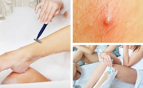 Aprenda a preparar um creme depilatório natural e evite os pelos encravados