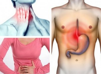 Você sabia que pode estar sofrendo de refluxo gastroesofágico?