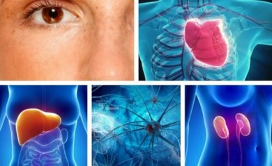 10 partes do corpo que o estresse afeta