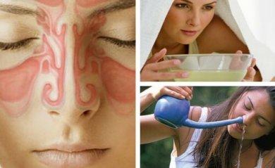 9 remédios caseiros para aliviar a sinusite