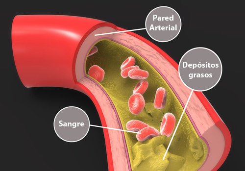 Como reduzir os triglicerídeos de forma natural Como reduzir os triglicerídeos de forma natural