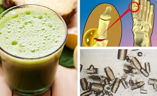 Como eliminar e dissolver os cristais de ácido úrico de forma natural Como eliminar e dissolver os cristais de ácido úrico de forma natural