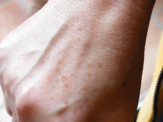 Como fazer cremes caseiros para manchas nas mãos