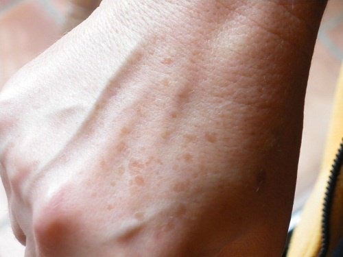 Como fazer cremes caseiros para manchas nas mãos