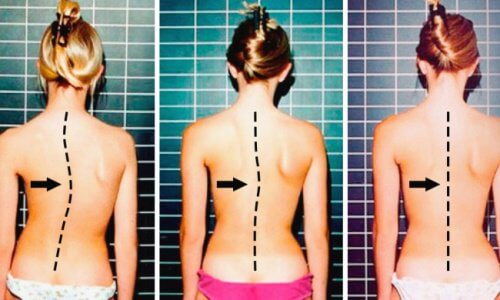 7 exercícios recomendados para acabar com a dor nas costas