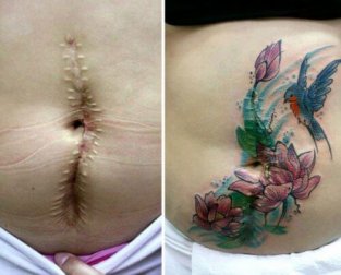 Tatuagens para “apagar” as feridas da vida