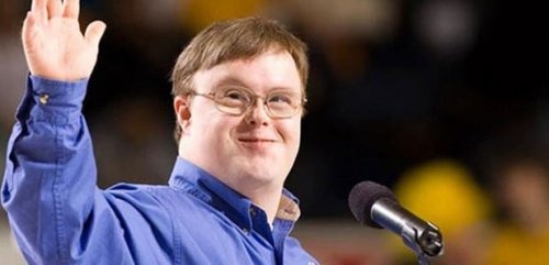 Jovem com síndrome de Down