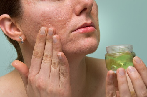 Mulher passando gel de aloe vera no rosto