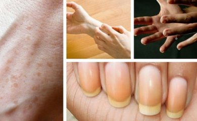 Dados curiosos que as mãos refletem sobre a saúde