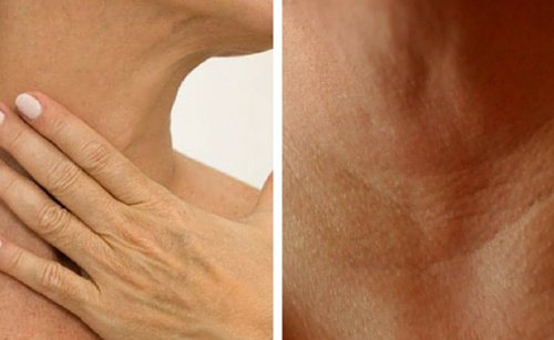 4 tratamentos para prevenir o surgimento de rugas no pescoço e nas mãos 4 tratamentos para prevenir o surgimento de rugas no pescoço e nas mãos