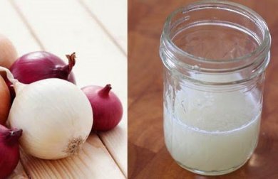 Como usar suco de cebola para controlar a queda de cabelo?