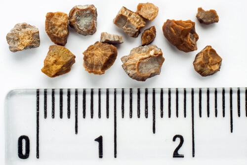 Dente-de-leão combate pedra nos rins