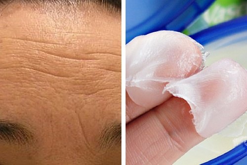 Cremes naturais para atenuar as rugas da testa