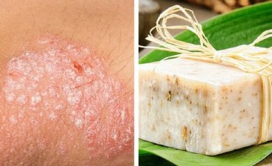 Receita de sabonete caseiro para peles com eczema