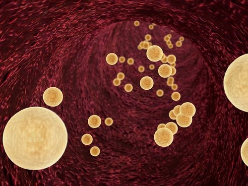 8 remédios naturais para controlar os níveis de triglicerídeos