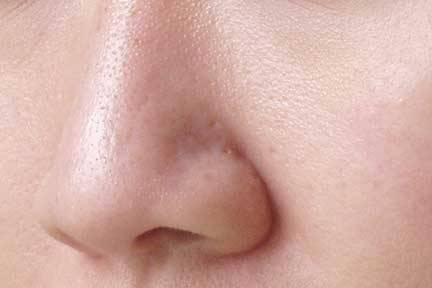 Aprenda a fechar os poros de forma natural Aprenda a fechar os poros de forma natural