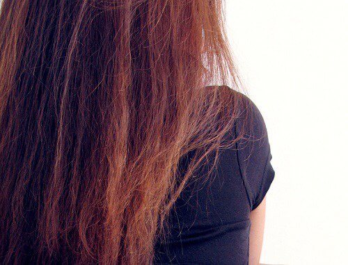 Queda de cabelo: causas e soluções Queda de cabelo: causas e soluções