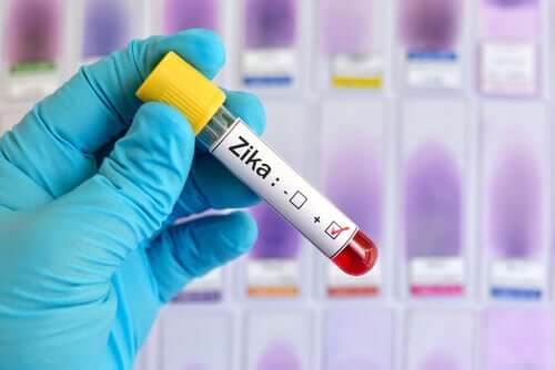 Alerta! Vírus da Zika: dez coisas que você deve saber