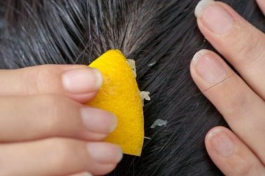 Como combater a queda de cabelo com suco de limão?