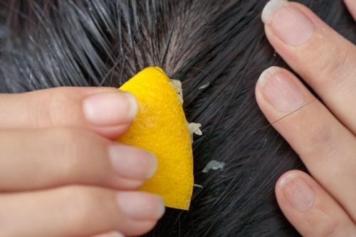 Como combater a queda de cabelo com suco de limão? Como combater a queda de cabelo com suco de limão?