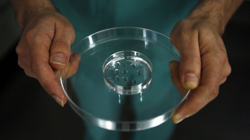 Fertilização in vitro livre de câncer de mama