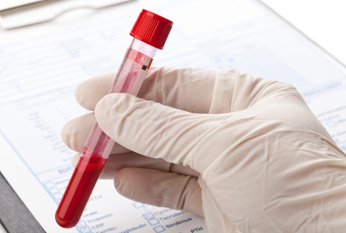 O Zikavírus pode ser detectado por um exame de sangue