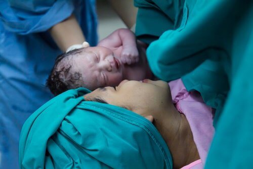 Bebês nascidos por cesárea recebem “banho” de bactérias vaginais