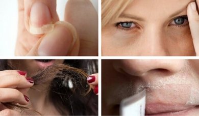 5 problemas estéticos comuns que podem indicar algo mais grave