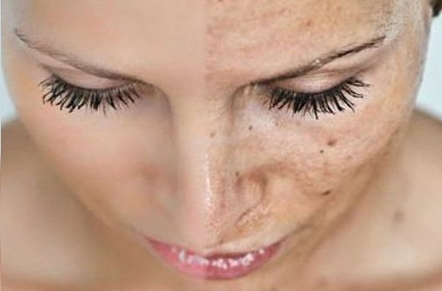 alho-combate-envelhecimento-precoce