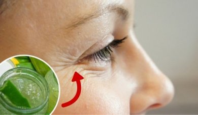 Pés de galinha: segredos para atenuá-los naturalmente