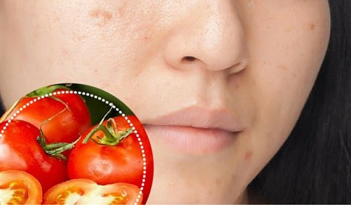 6 ingredientes naturais para atenuar manchas no rosto 6 ingredientes naturais para atenuar manchas no rosto